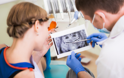 The Healing Process After Getting Dental Implants: What to Expect