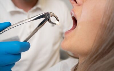 Top Tips for a Smooth Wisdom Teeth Removal Recovery