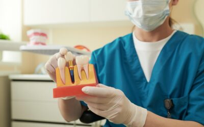 The Step-by-Step Dental Implant Procedure Explained