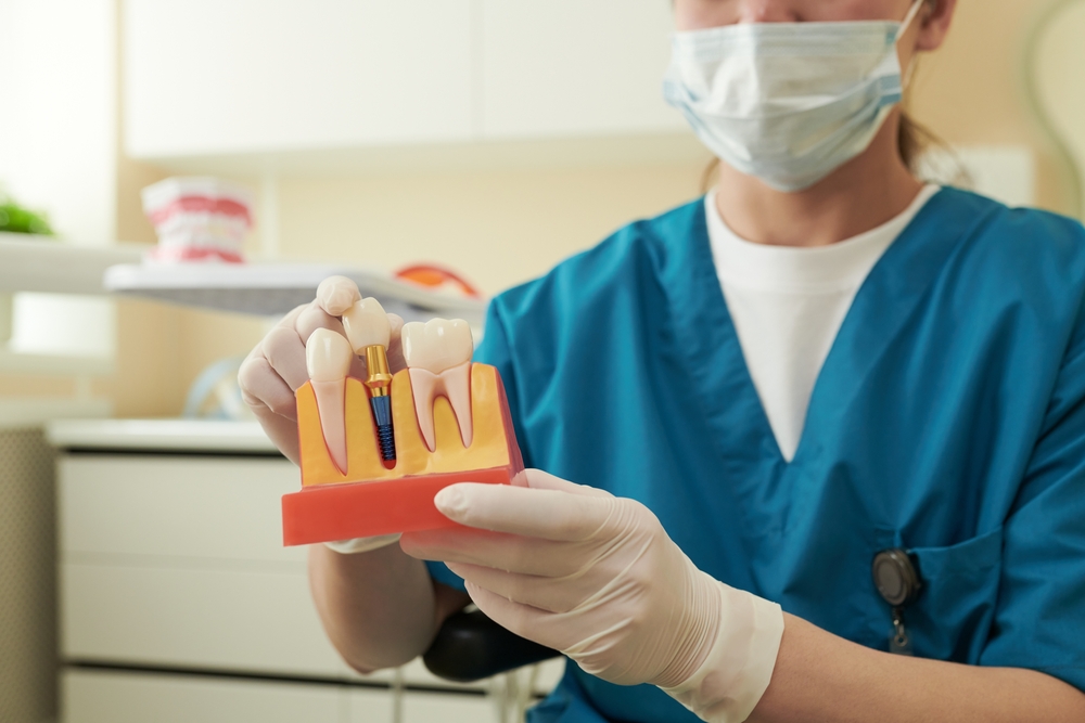 The Step-by-Step Dental Implant Procedure Explained